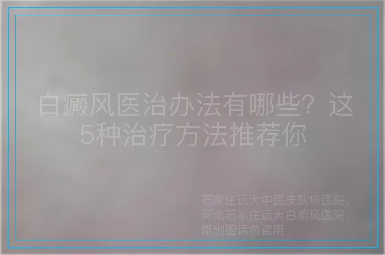 白癜风医治办法有哪些？这5种治疗方法推荐你
