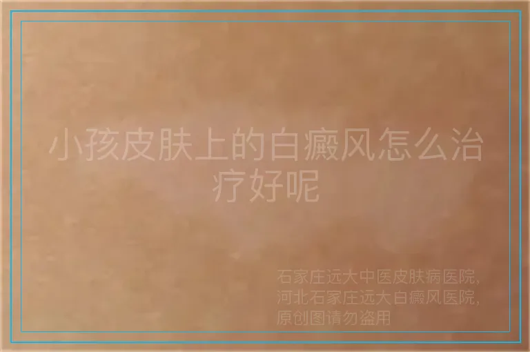 小孩皮肤上的白癜风怎么治疗好呢
